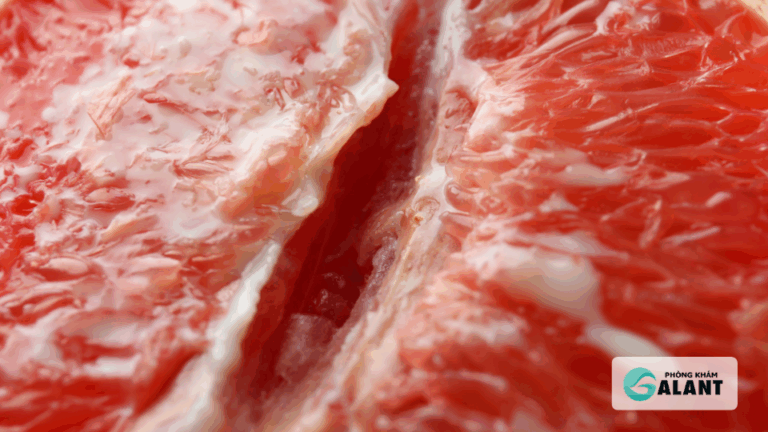 Triệu chứng Chlamydia ở nữ