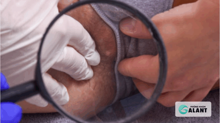 Triệu chứng ban đầu của Giang mai