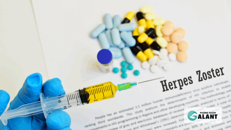 điều trị herpes sinh dục