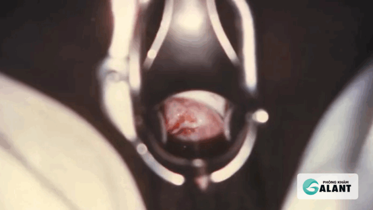 Biến chứng lậu