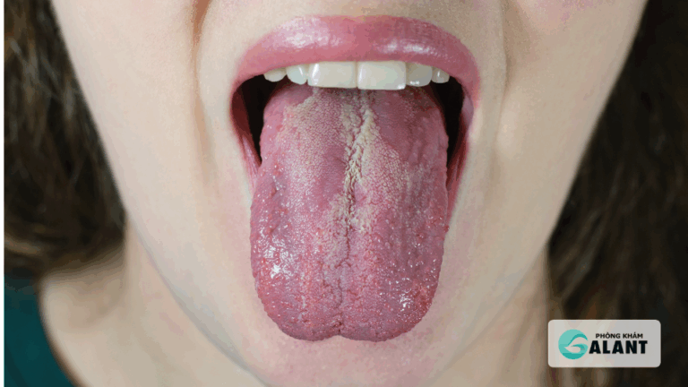 STDs có thể lây qua đường miệng