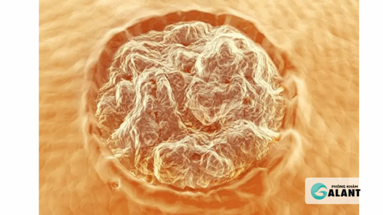 cơ chế hình thành sùi mào gà